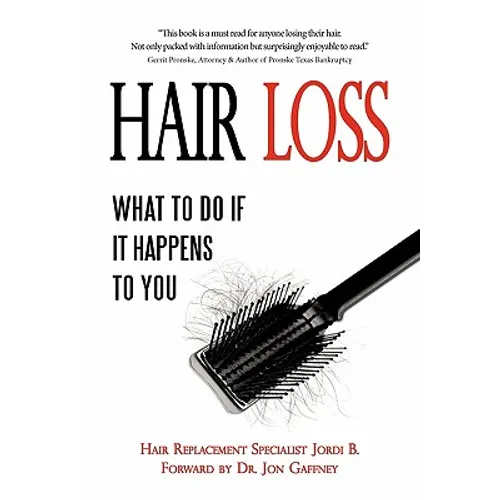 Hair Loss: What to do if it Happens to You - Hardcover