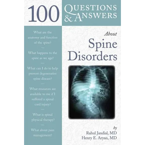 100 Q&as about Spine Disorders - Paperback