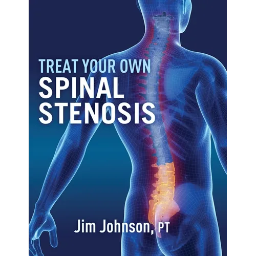 Treat Your Own Spinal Stenosis - Paperback