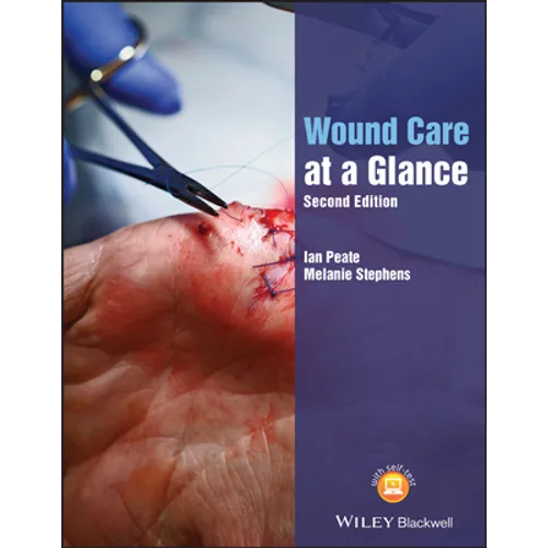 Wound Care at a Glance, Second Edition - Paperback