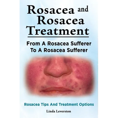 Rosacea and Rosacea Treatment. From A Rosacea Sufferer To A Rosacea Sufferer. Rosacea Tips And Treatment Options - Paperback