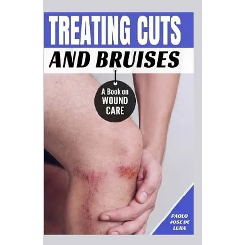 Treating Cuts and Bruises: A Book on Wound Care - Paperback