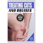 Treating Cuts and Bruises: A Book on Wound Care - Paperback