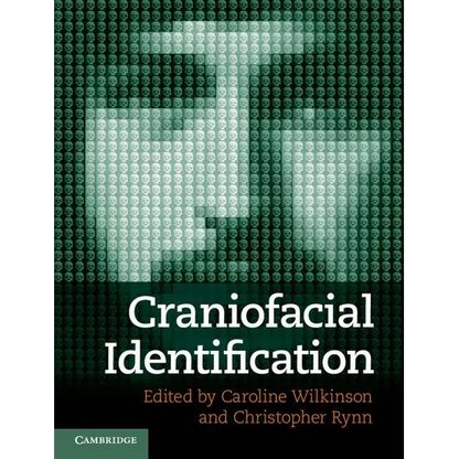 Craniofacial Identification - Hardcover