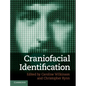 Craniofacial Identification - Hardcover