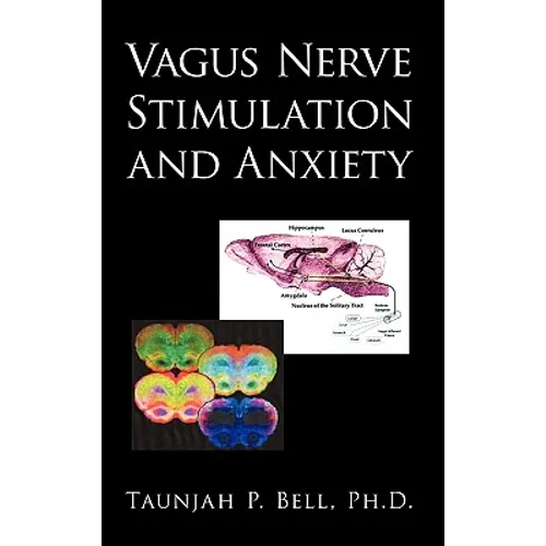Vagus Nerve Stimulation and Anxiety - Paperback
