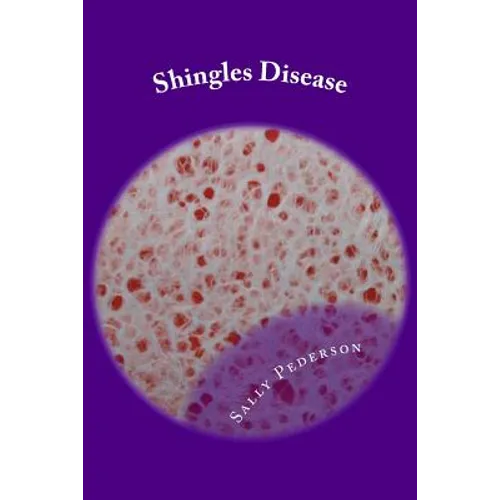Shingles Disease: The Complete Guide - Paperback