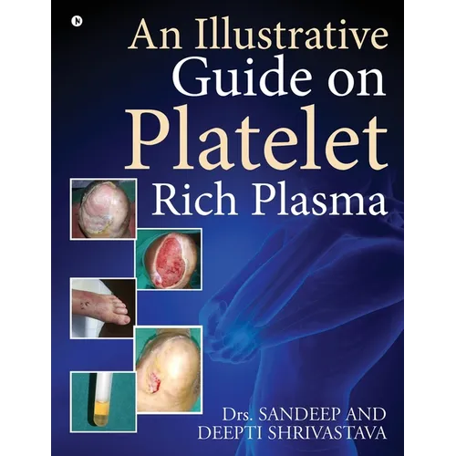 An Illustrative Guide on Platelet Rich Plasma - Paperback