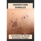 Understand Shingles: Everything You Should Know About Shingles: Shingles Topical Treatment - Paperback