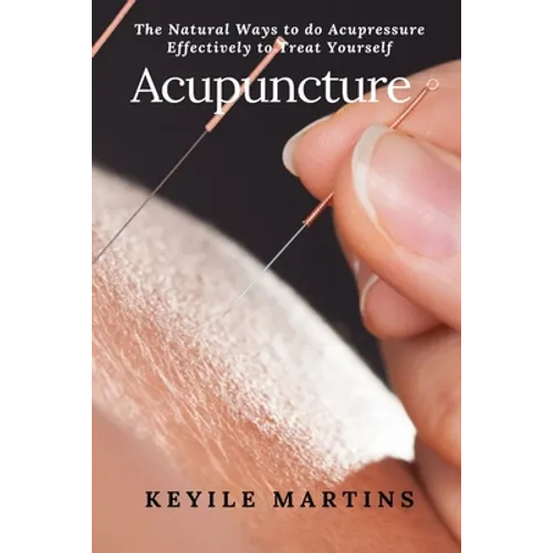 Acupuncture: The Natural Ways to do Acupressure Effectively to Treat Yourself - Paperback