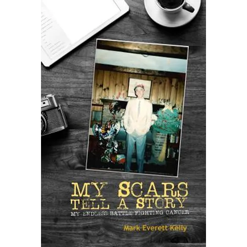 My Scars Tell a Story - Paperback