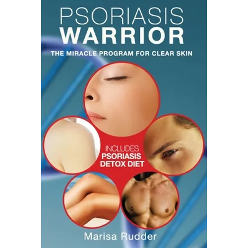 Psoriasis Warrior: The Miracle Program for Clear skin - Paperback