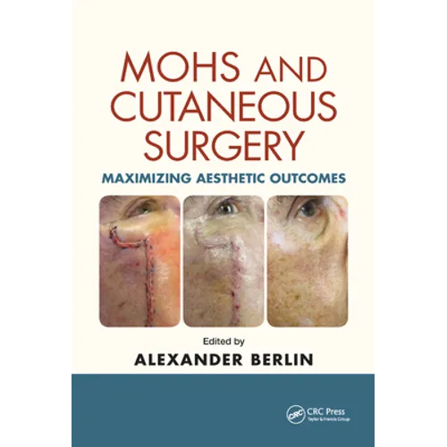 Mohs and Cutaneous Surgery: Maximizing Aesthetic Outcomes - Paperback