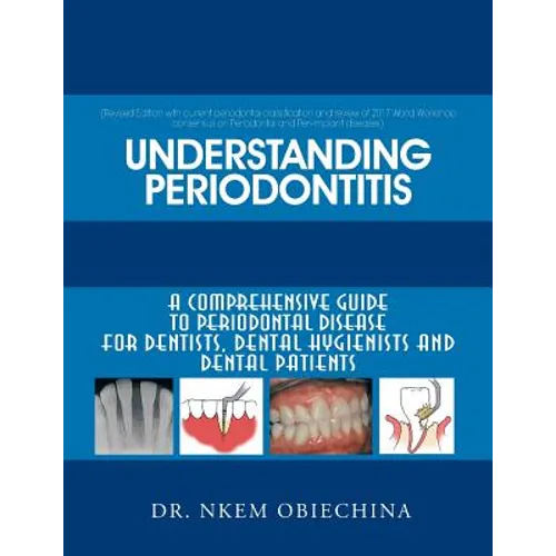 Understanding Periodontitis: A Comprehensive Guide to Periodontal Disease for Dentists, Dental Hygienists and Dental Patients - Paperback