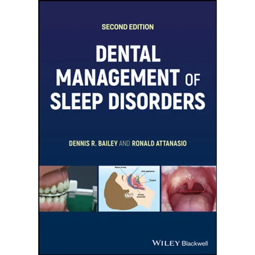 Dental Management of Sleep Disorders - Paperback