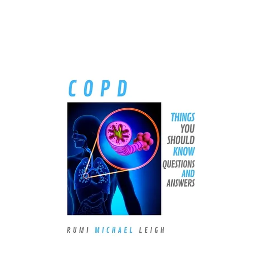 Copd: Things you should know (Questions and Answers) - Paperback