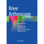 Knee Arthroscopy: How to Succeed - Paperback
