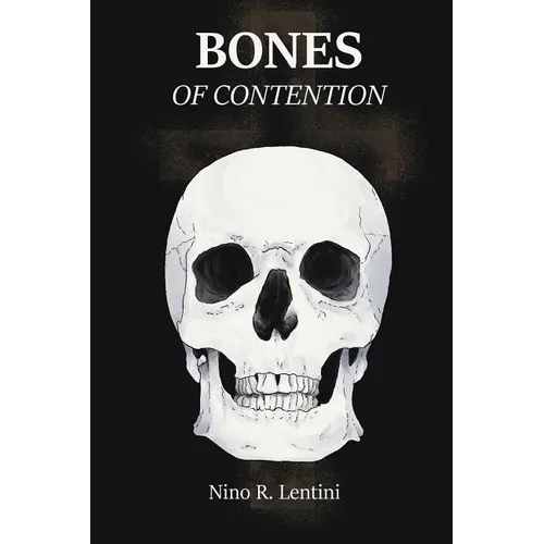 Bones of Contention - Paperback