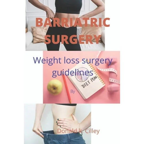 Barriatric Surgery: Weight loss surgery guidelines - Paperback