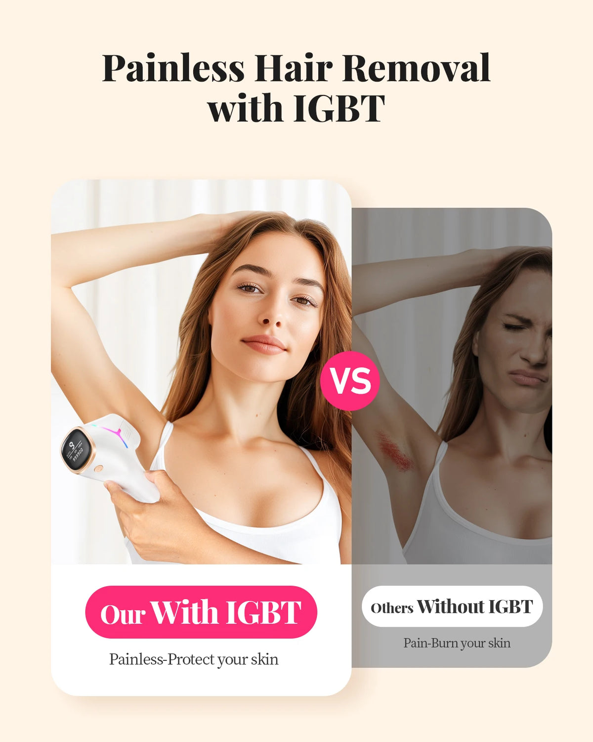 IPL Hair Removal Device – 990,000 Flashes, 9 Energy Levels, Painless Permanent Hair Removal for Women & Men, Face, Body & Bikini, US/EU/UK Plug