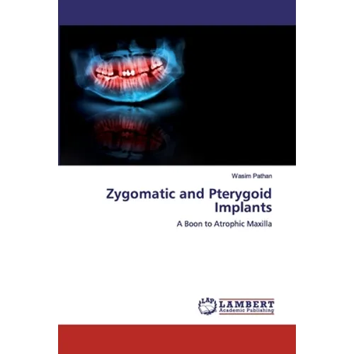 Zygomatic and Pterygoid Implants - Paperback