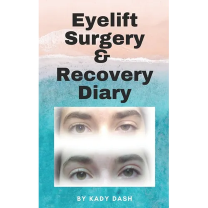 Eyelift Surgery and Recovery Diary: Ptosis, eyelifts, punctal plugs, and dry eyes - Paperback