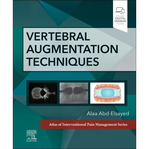Vertebral Augmentation Techniques - Hardcover