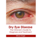 Dry Eye Disease: The Clinician's Guide to Diagnosis and Treatment - Hardcover