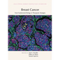 Breast Cancer: From Fundamental Biology to Therapeutic Strategies - Hardcover