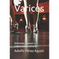 Varices: Síntomas, causas y tratamiento natural - Paperback
