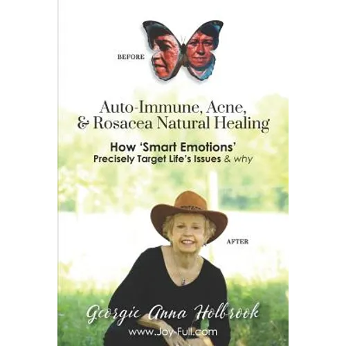 Auto-Immune, Acne, & Rosacea Natural Healing - How 'Smart Emotions' Precisely Target Life's Issues & Why - Paperback