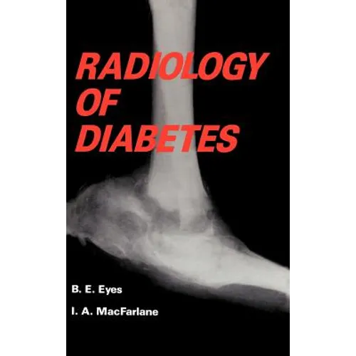 Radiology of Diabetes - Hardcover