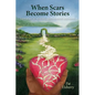 When Scars Become Stories: A Journey of Healing, Restoration & Faith - Paperback