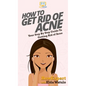 How To Get Rid of Acne: Your Step By Step Guide To Getting Rid of Acne - Hardcover
