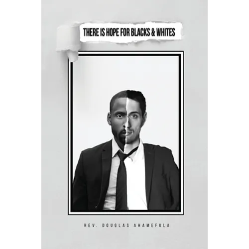 There Is Hope for Blacks & Whites - Paperback