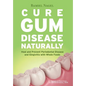 Cure Gum Disease Naturally: Heal Gingivitis and Periodontal Disease with Whole Foods - Paperback