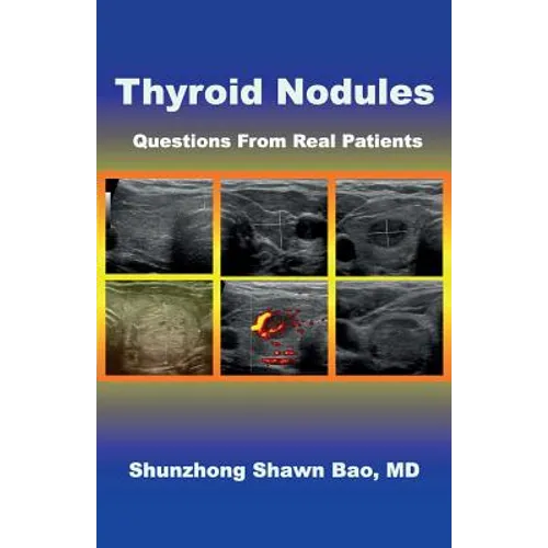 Thyroid Nodules: Questions From Real Patients - Paperback