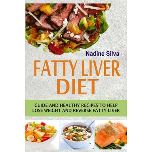 Fatty Liver Diet: Guide And Healthy Recipes To Help Lose Weight And Reverse Fatty Liver - Paperback