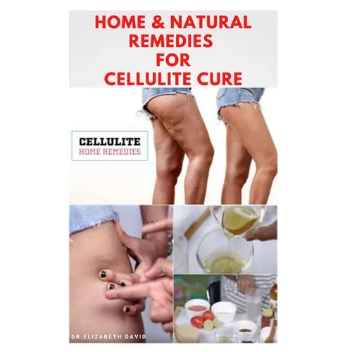 Home & Natural Remedies for Cellulite Cure: Practical Guide On The Best Remedies To Get Rid Of Your Cellulite: Everything You Need To Know - Paperback
