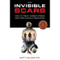 Invisible Scars: How to Treat Combat Stress and PTSD without Medication - Paperback