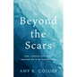 Beyond the Scars: How I Learned God Didn't Abandoned Me in My Darkest Hour - Paperback