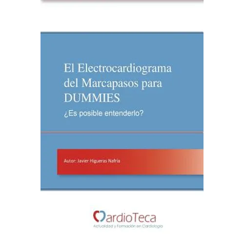 El Electrocardiograma del Marcapasos para DUMMIES. ¿Es posible entenderlo?: Guía sencilla para médicos no cardiólogos para entender de una vez por tod - Paperback