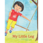 My Little Leg - Paperback