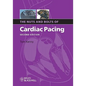 Nuts Bolts Cardiac Pacing 2e - Paperback