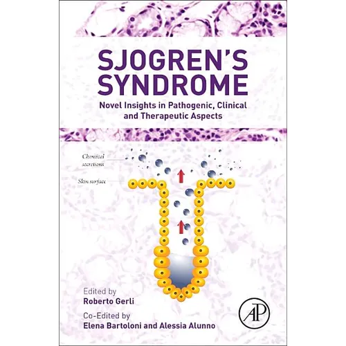 Sjogren's Syndrome: Novel Insights in Pathogenic, Clinical and Therapeutic Aspects - Hardcover