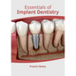 Essentials of Implant Dentistry - Hardcover