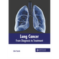 Lung Cancer: From Diagnosis to Treatment - Hardcover