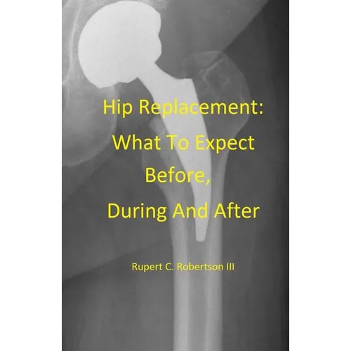 Hip Replacement: What To Expect Before, During and After - Paperback