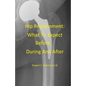 Hip Replacement: What To Expect Before, During and After - Paperback