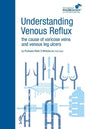Understanding Venous Reflux the Cause of Varicose Veins and Venous Leg Ulcers: Varicose veins and venous leg ulcers - Paperback